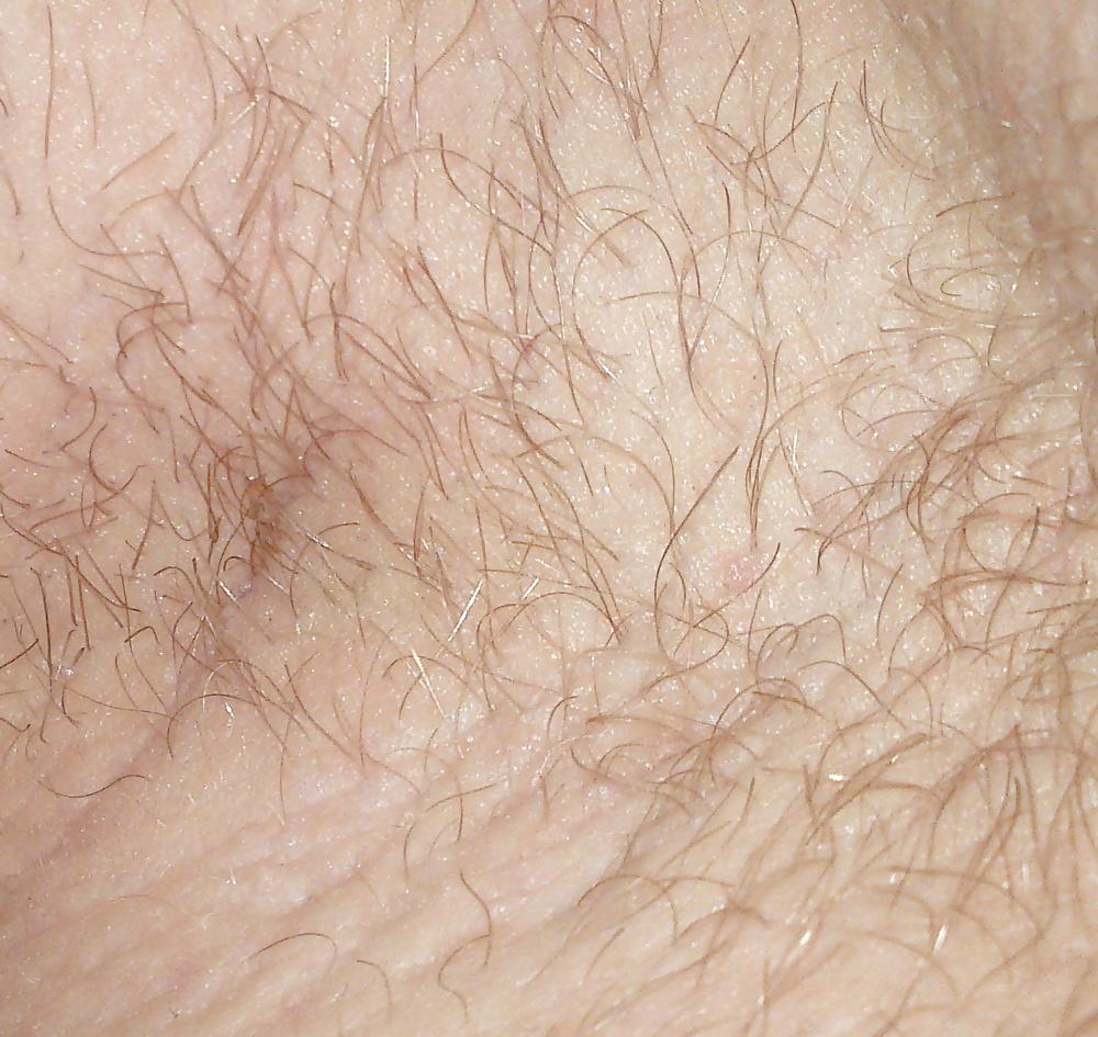 25P HD Armpit