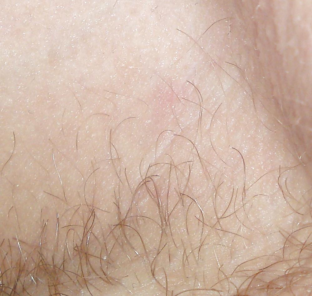 25P HD Armpit