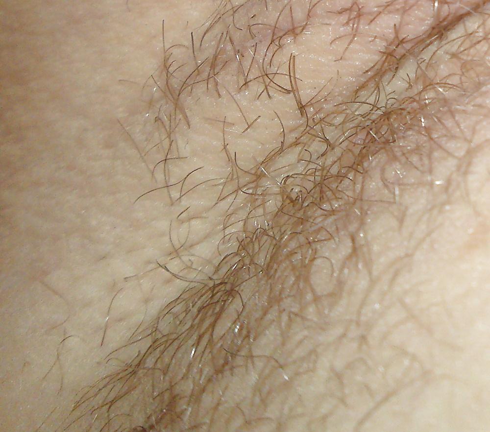 25P HD Armpit