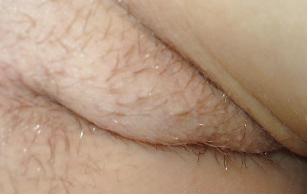 25P HD Armpit