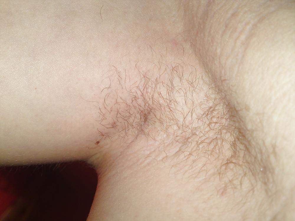 25P HD Armpit