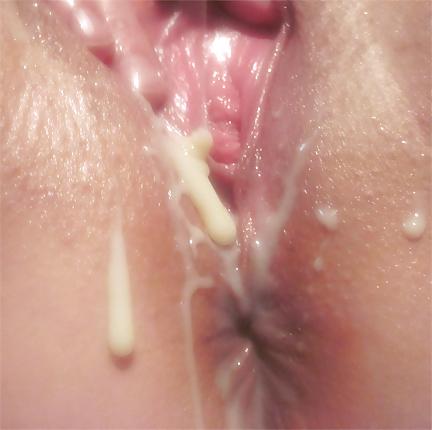 25P Sweetened condensed milk