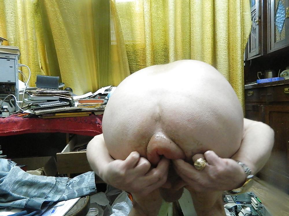25P Anus libe
