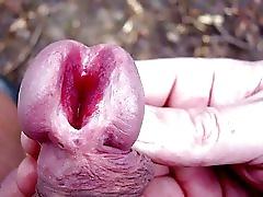 25P Anus libe