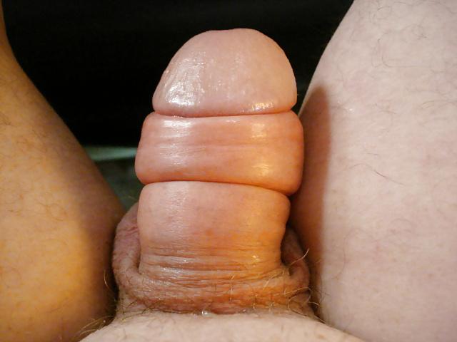 25P Anus libe