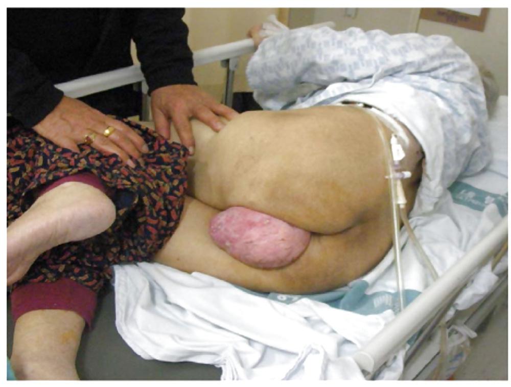 25P Prolapse in elderly ladies is lickable and suckable part 4
