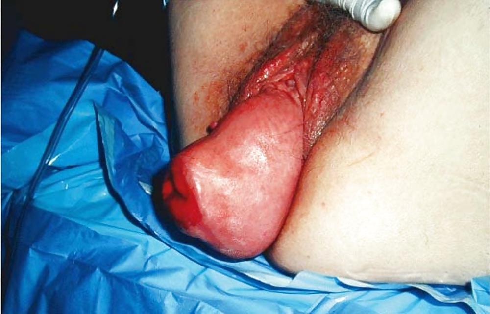 25P Prolapse in elderly ladies is lickable and suckable part 4