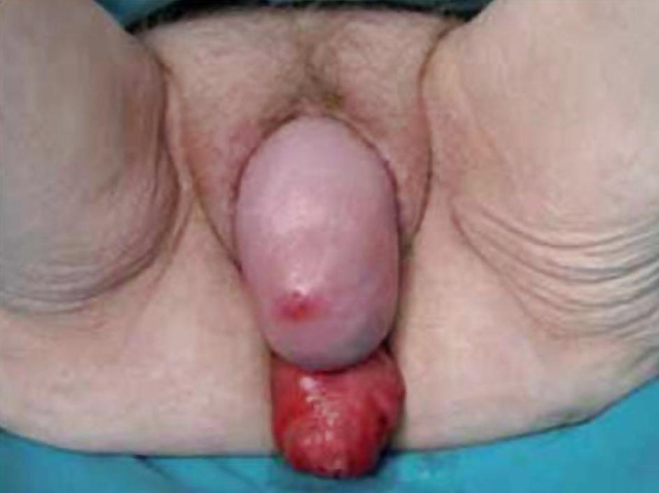 25P Prolapse in elderly ladies is lickable and suckable part 4