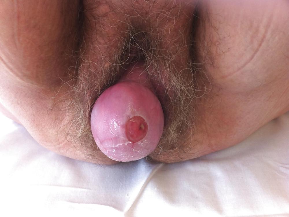 25P Prolapse in elderly ladies is lickable and suckable part 4