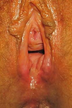23P Prolapse in elderly ladies is lickable and suckable 3