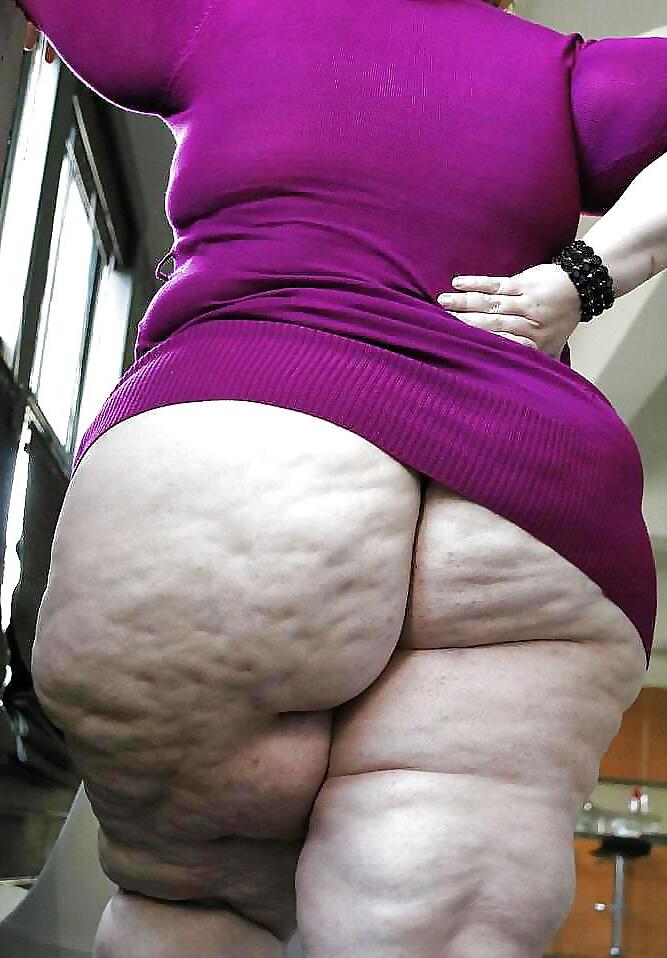 22P Fat and Cellulite
