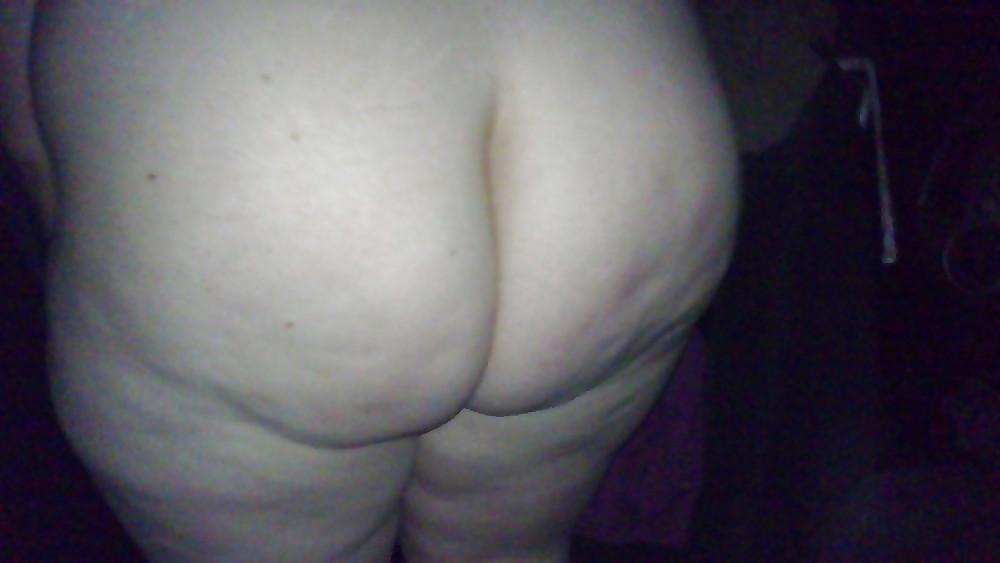 22P Fat and Cellulite