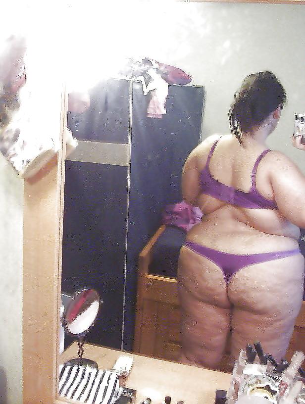 22P Fat and Cellulite