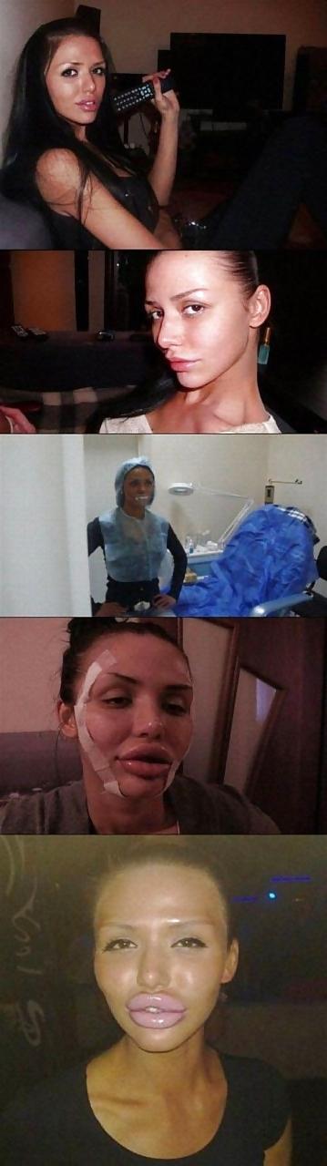 25P Before and After - Bimbo Edition