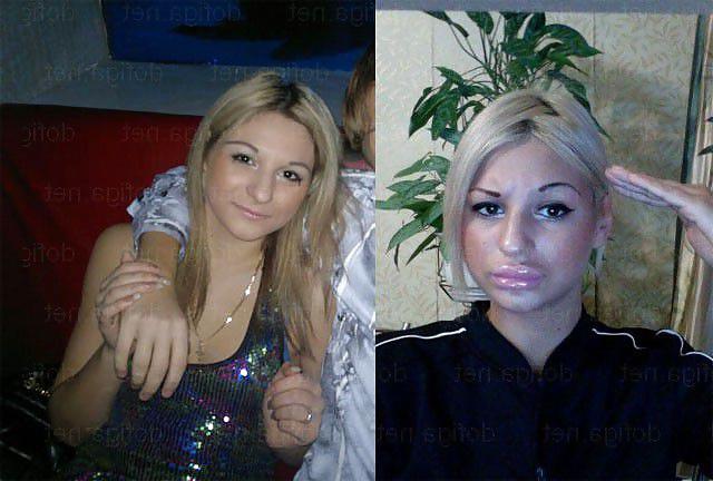 25P Before and After - Bimbo Edition