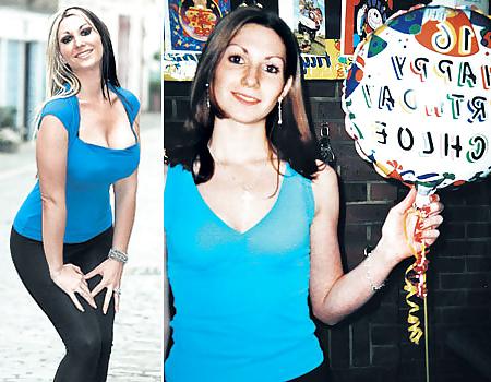 25P Before and After - Bimbo Edition