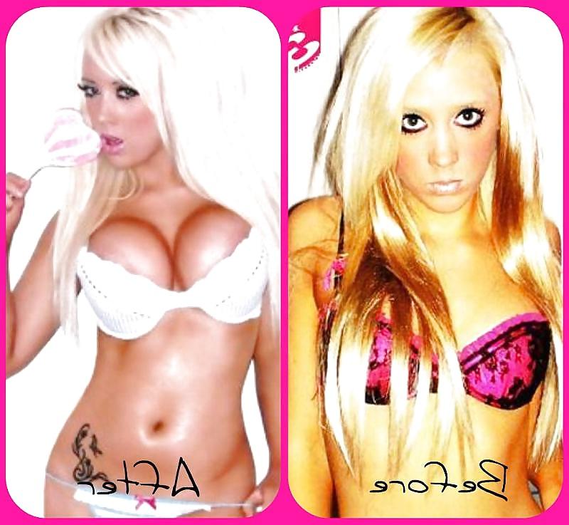 25P Before and After - Bimbo Edition