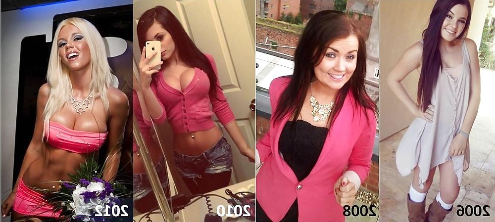 25P Before and After - Bimbo Edition
