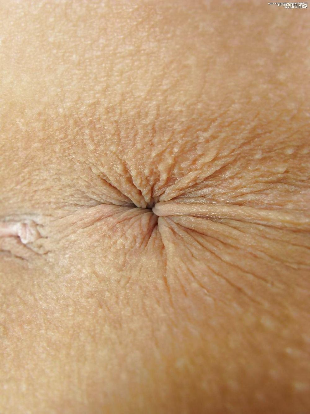 25P Anus