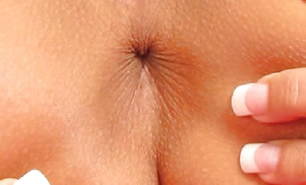 25P Anus