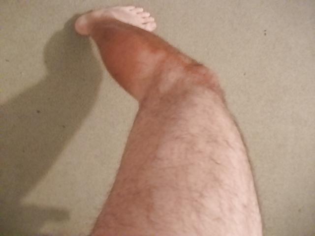 11P Nice Athleat Thick Nob