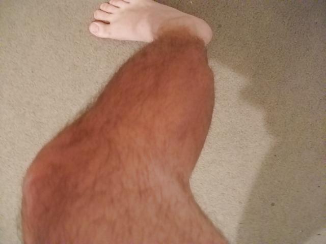 11P Nice Athleat Thick Nob