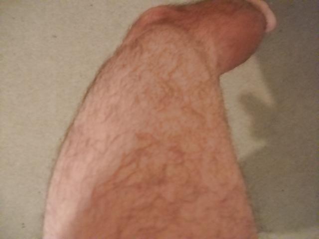 11P Nice Athleat Thick Nob