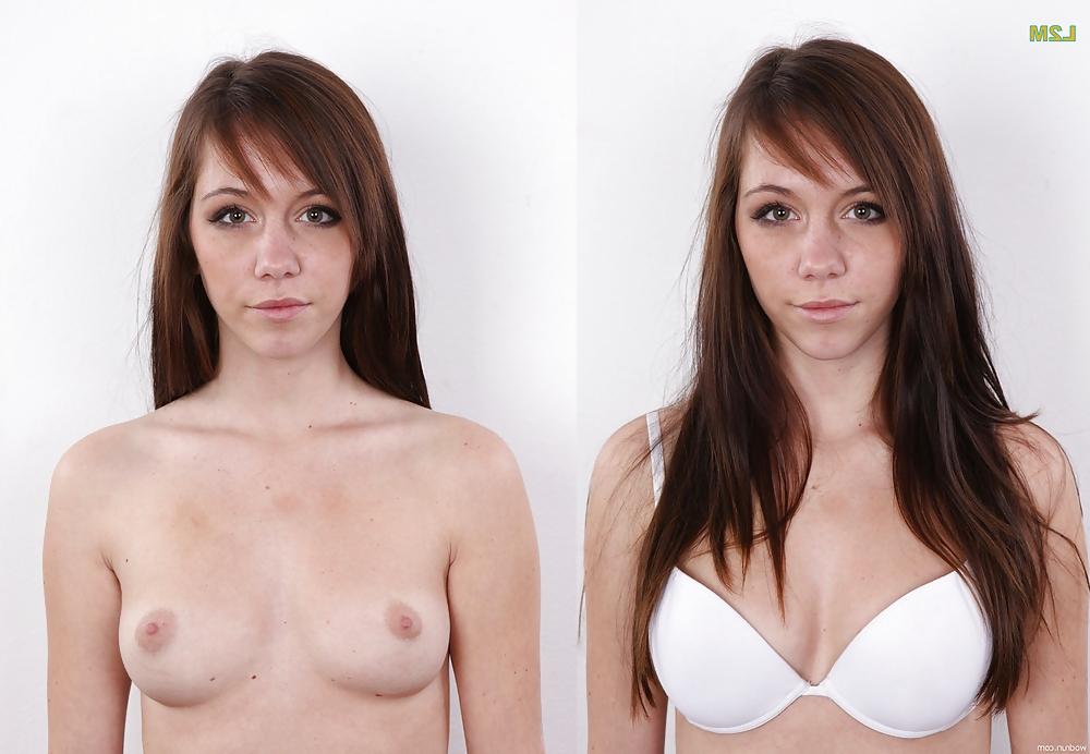 25P Even Still More Dressed Undressed Beauties