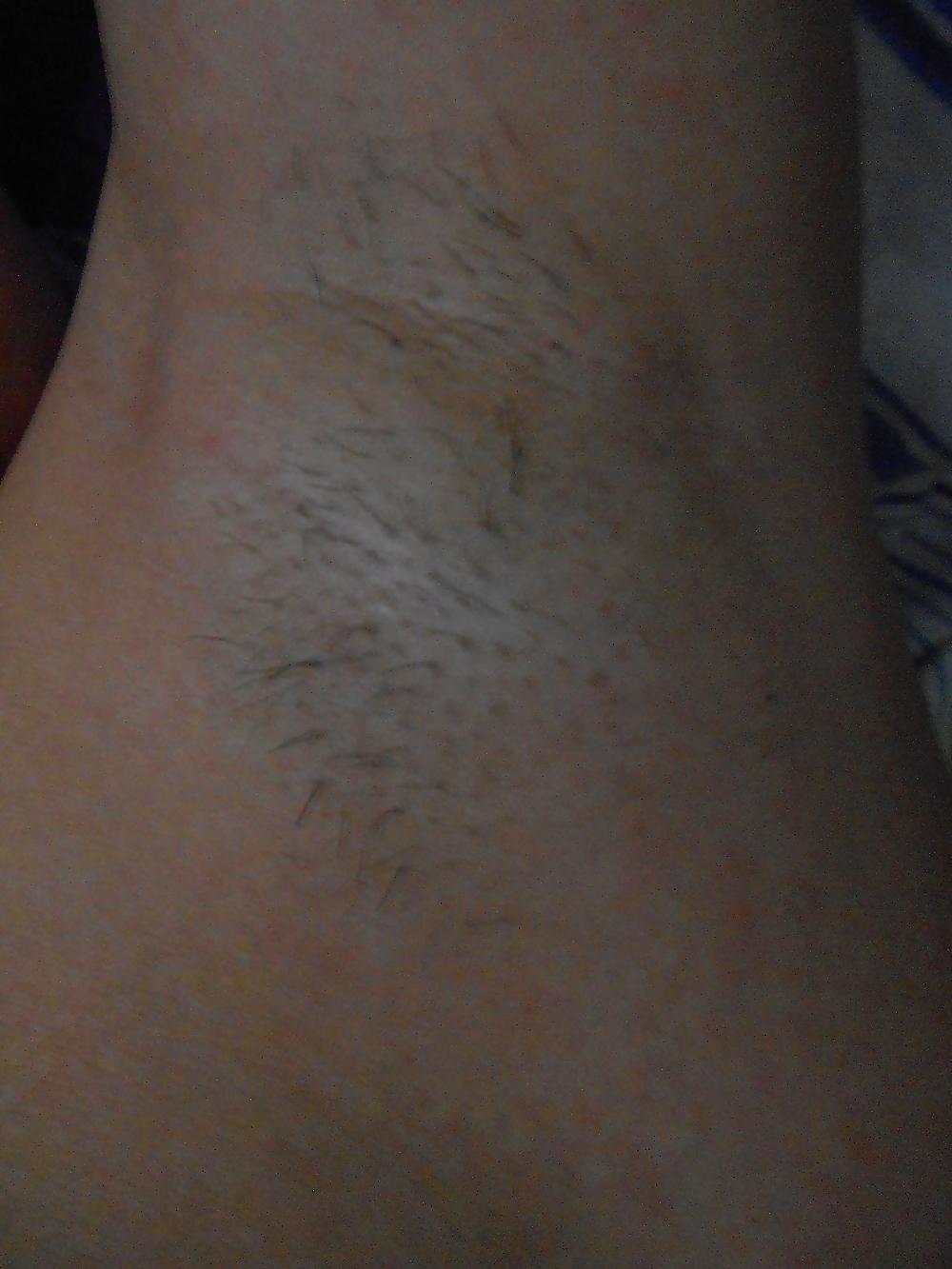 20P Armpit kingdom 2