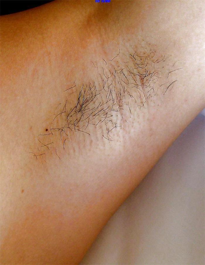 20P Armpit kingdom 2