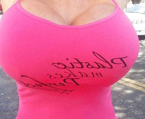 25P Fake titted bimbo sluts