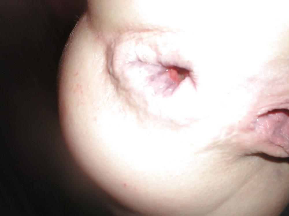 22P Strawberry Fields Forever (Prolapse)