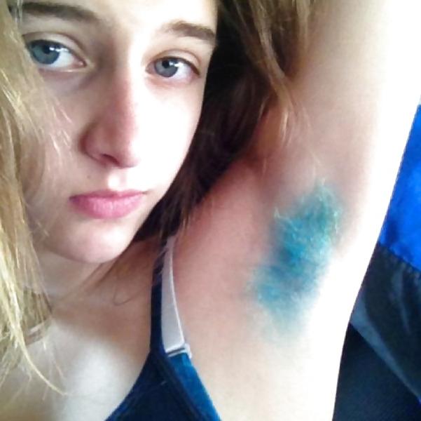 11P Colorful Hairy Armpit