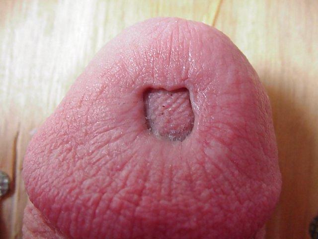 25P Damaged cock head
