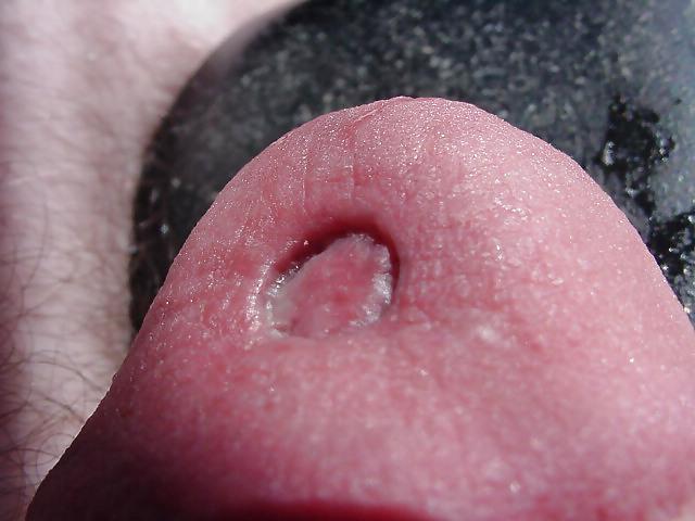 25P Damaged cock head