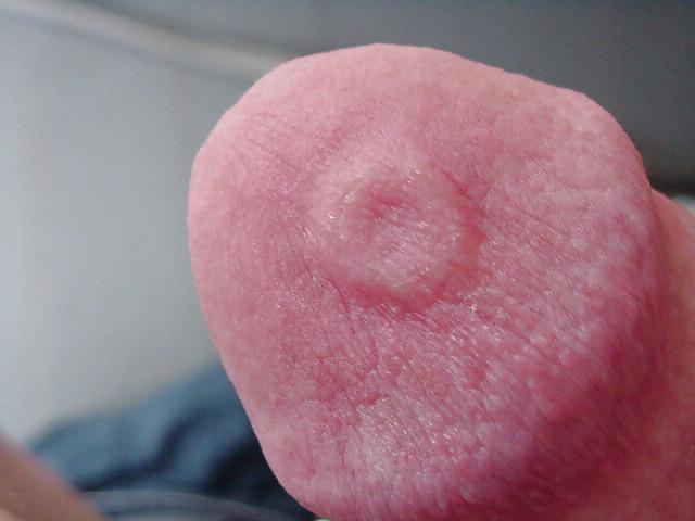 25P Damaged cock head