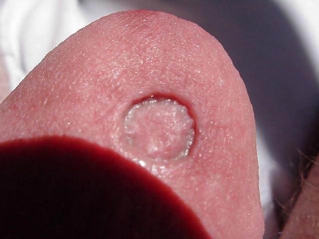 25P Damaged cock head
