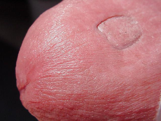 25P Damaged cock head