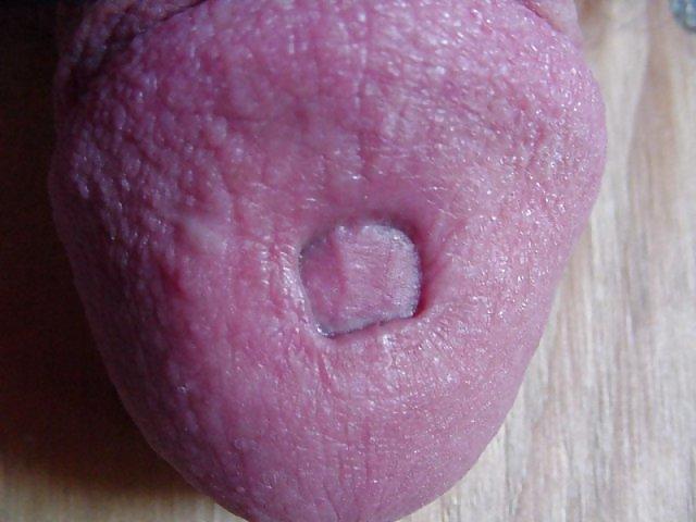25P Damaged cock head