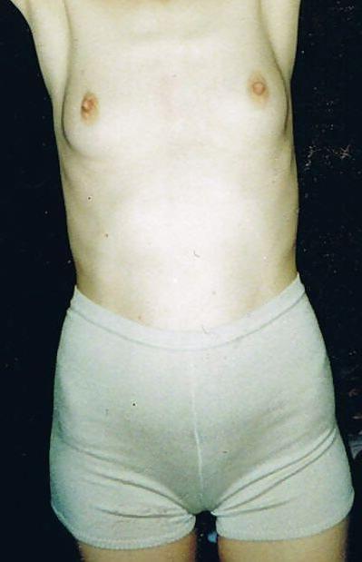25P Private slit wide open