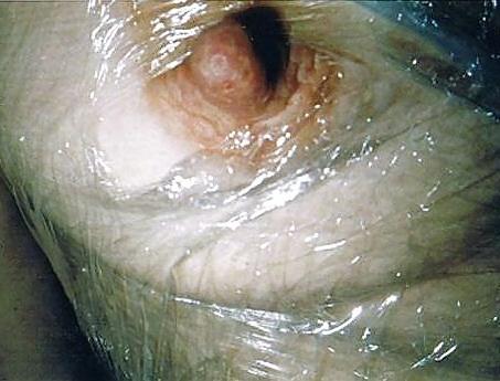 25P Private slit wide open
