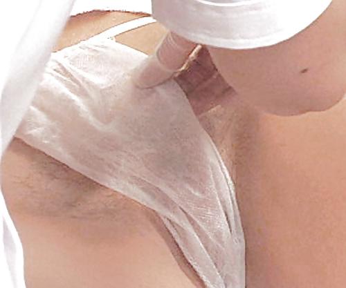 17P Brazilian wax