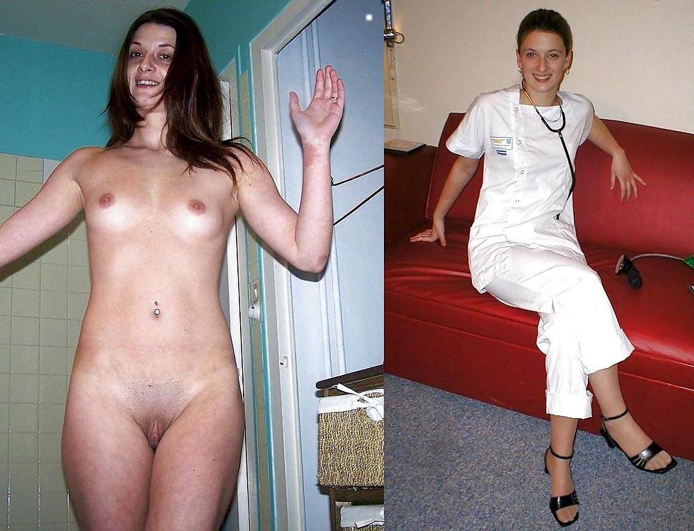 20P Before after 316 (small tits special)