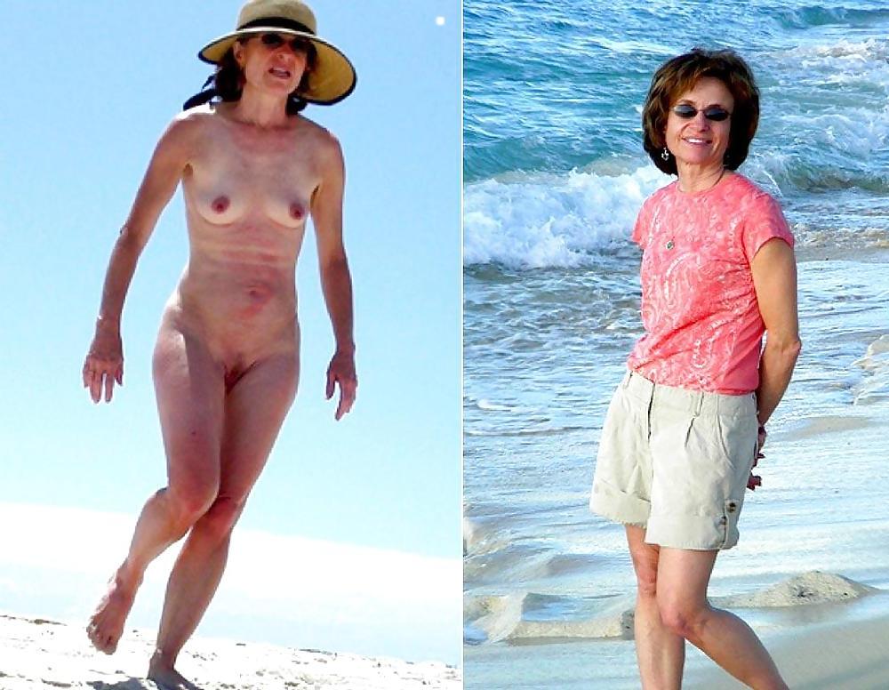 20P Before after 316 (small tits special)