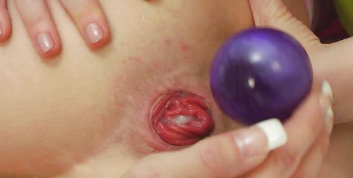 25P Prolapse 7... :D