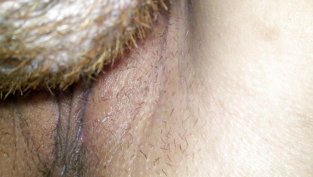 24P Ex fat pussy lips