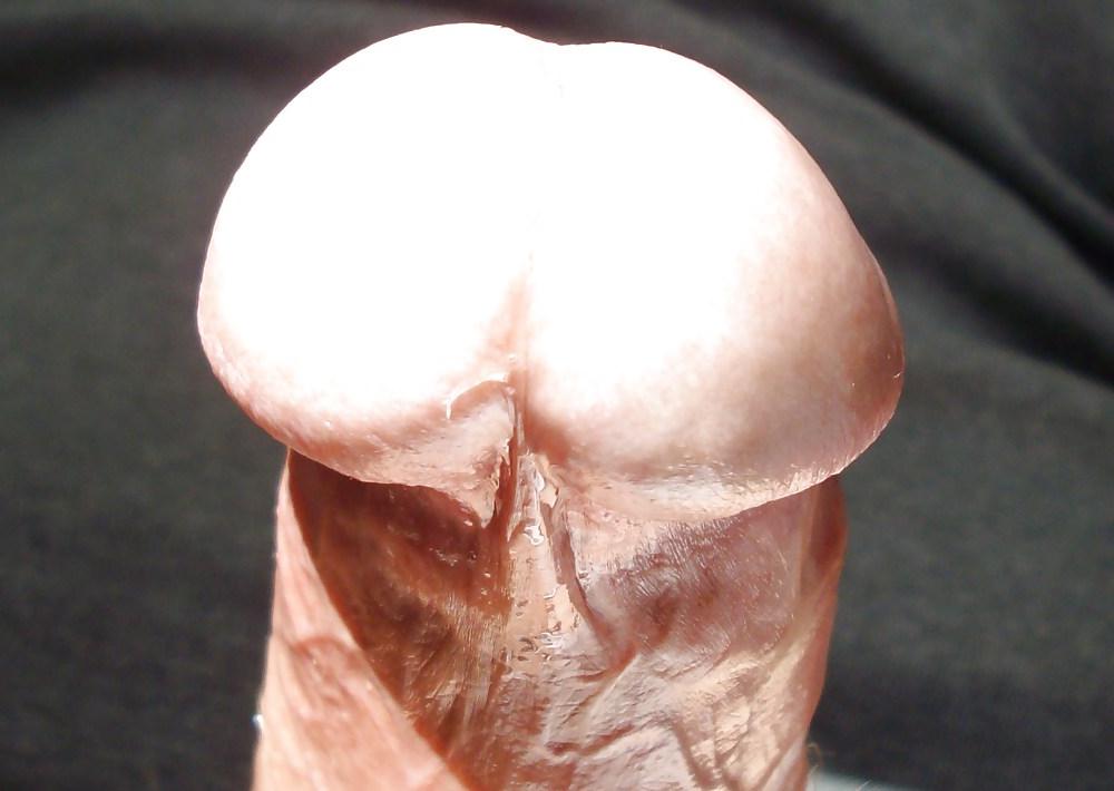11P FRANK'S HUGE COCK: Detail of Head