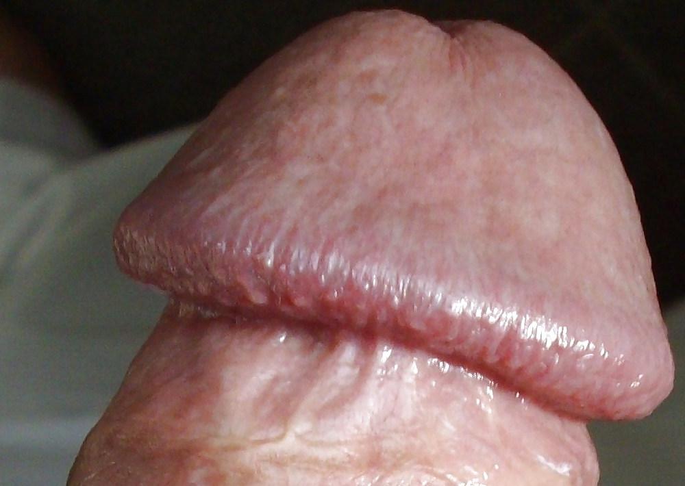 11P FRANK'S HUGE COCK: Detail of Head