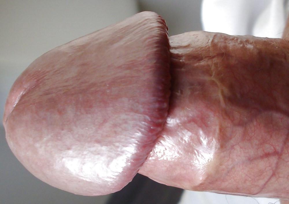 11P FRANK'S HUGE COCK: Detail of Head