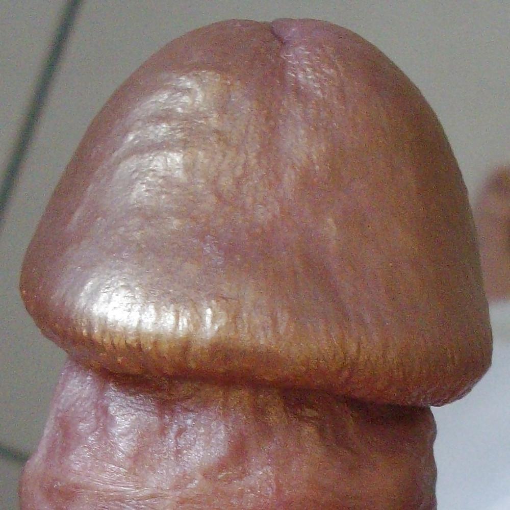11P FRANK'S HUGE COCK: Detail of Head